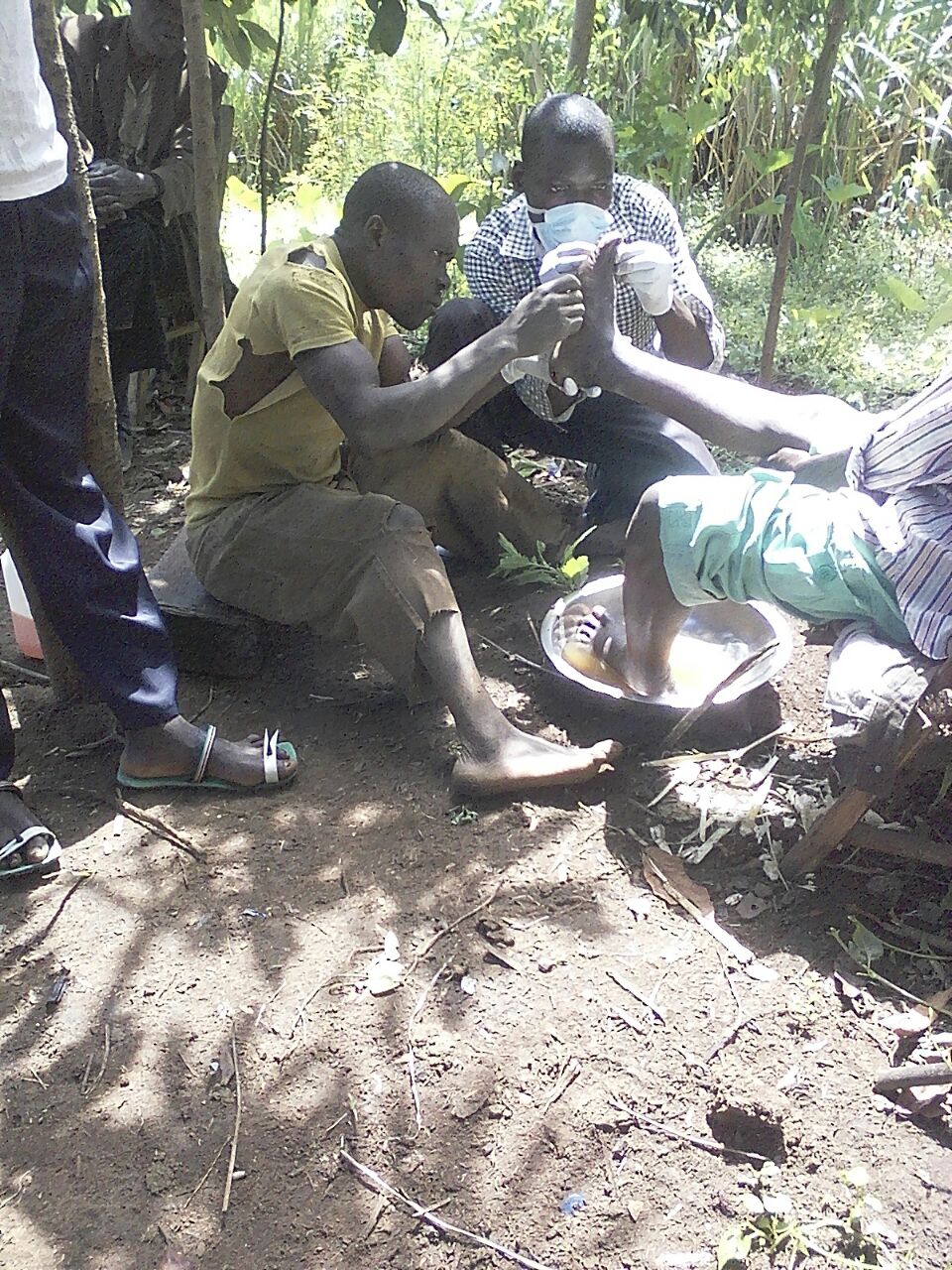 Jiggers the Scourge of Village Life in Africa Kingdom Driven Ministries